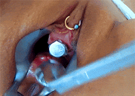 Urethral play