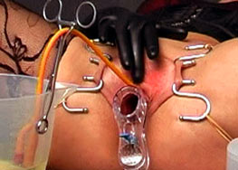 Urethral play