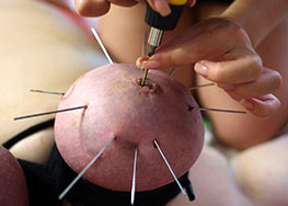 Pricking of tits